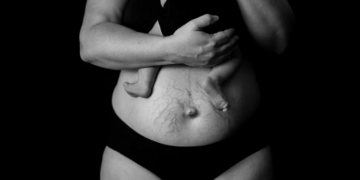 Женщина после рождения ребенка