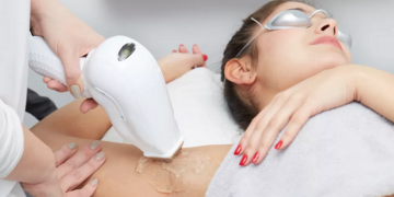 Що потрібно знати про лазерну епіляцію та поради