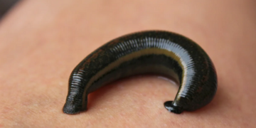 Как использовать правильно аптечные пиявки и их достоинства