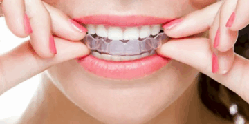 Выравнивание зубов: что нужно знать, особенности и правила