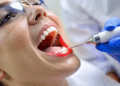 Особенности лечения десен с профессионалами и советы
