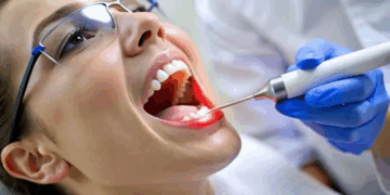 Особенности лечения десен с профессионалами и советы
