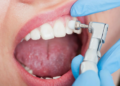 Обзор правил и преимуществ профессиональной чистки зубов для здоровья полости рта
