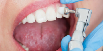 Обзор правил и преимуществ профессиональной чистки зубов для здоровья полости рта