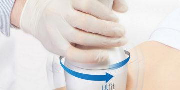 Липолиз с ULFIT: особенности, достоинства и правила